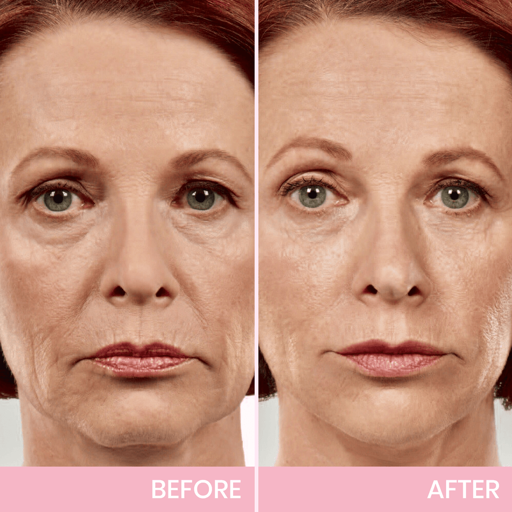 🎄CHRISTMAS SALE - 70% OFF in the Last 3 Hours!🎁 Give the Gift of Beauty This Christmas with BBOJI™ V-Face Tape for a Stunning Look.💄 Hurry! 🐰