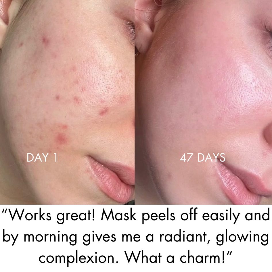 SeoulMori© Collagen Glass Mask