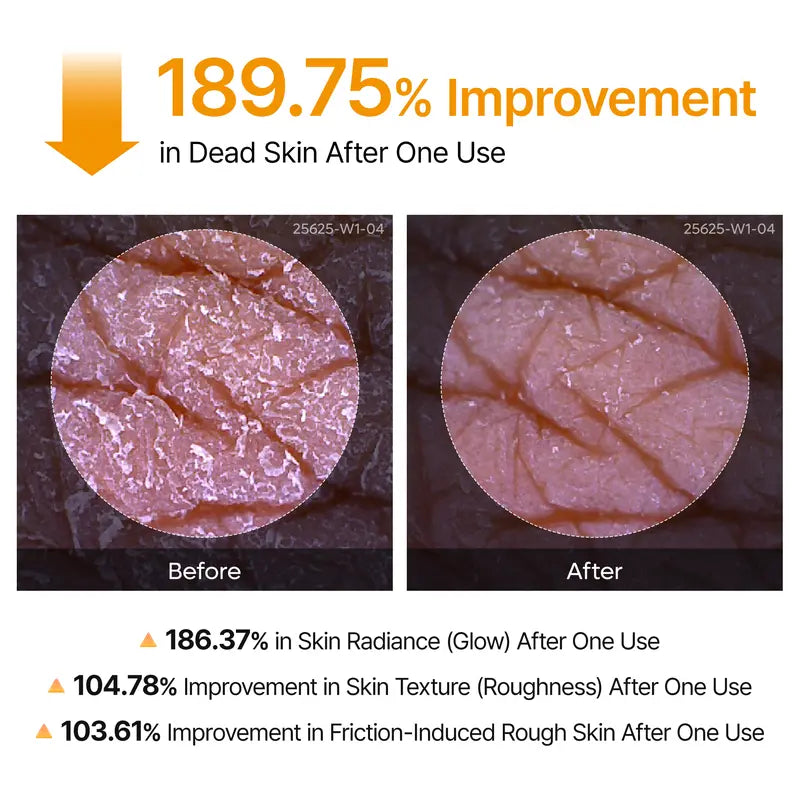 🌟 Smooth & Radiant Skin Fast – 200ml Kojic Acid + Turmeric Peel Spray ✨🧴